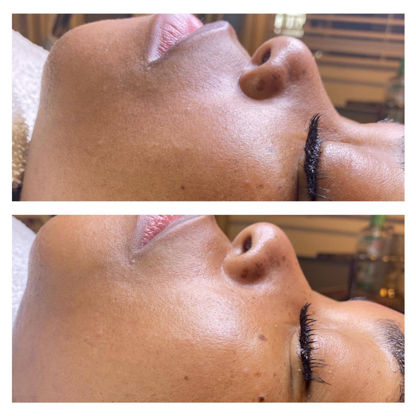 Can yall spot the difference in this before and after picture Comment below which service you think this client had done!