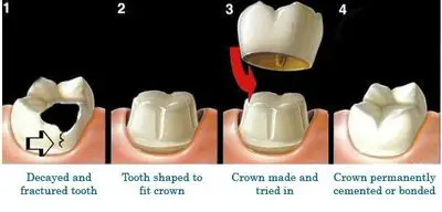 Spalding Dental: Charles S. Spalding, DMD, Shannon J.M. Spalding DMD