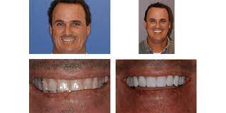 Arizona Advanced Dental