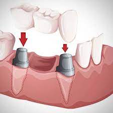 Tri-Lakes Dentistry - Hot Springs