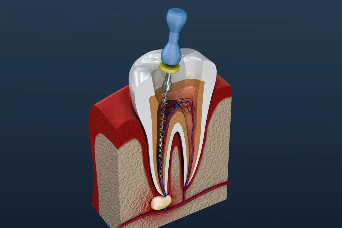 Downtown Dental Care