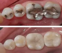 Bold Dental