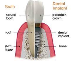 Premier Dental