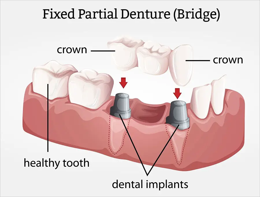 Ethan Ake, DDS