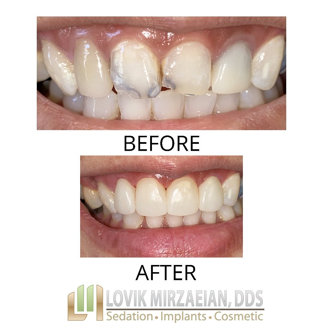 Dr. Lovik Mirzaeian DDS