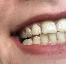 Pocasangre Oliva Dental