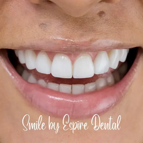 Espire Dental | Briargate