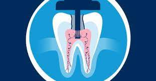 Front Range Endodontics