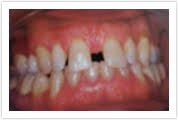 Gleneagle Dental, Dr. Michael Wonnacott, DDS