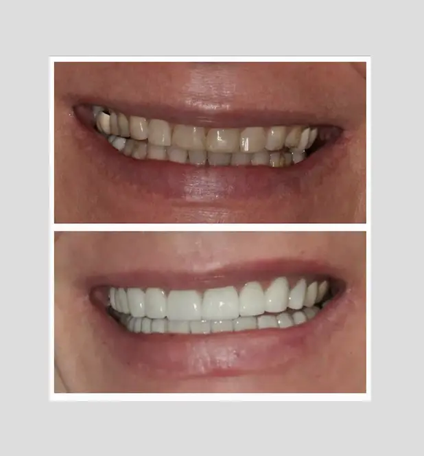 EsthetiX Prosthodontics