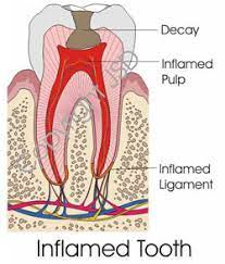 SoCo Endo, Dr. Tyler J. Boss DDS, Board Certified Endodontist