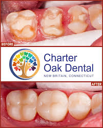 Charter Oak Dental