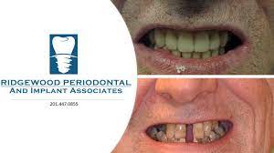 Connecticut Periodontal & Implant Associates