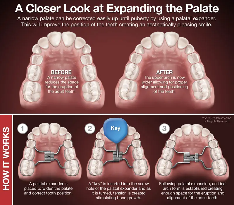 Weeks Orthodontics