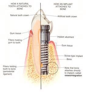 Burris Cosmetic and Family Dentistry