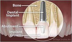 Capitol Dental Group