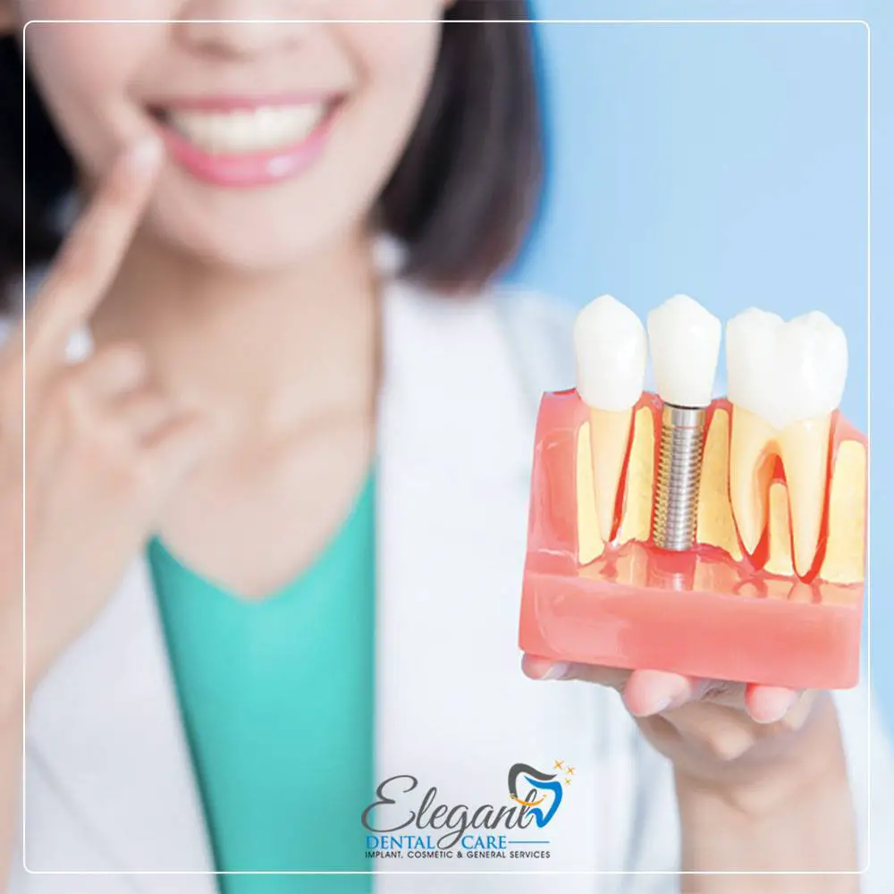 Elegant Dental Care