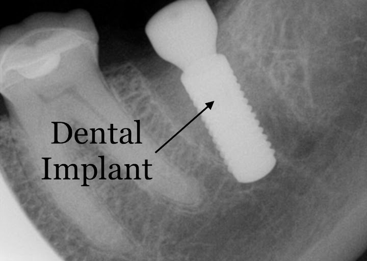 Idaho Falls Smiles David M Heninger DDS and Justin G Frandsen DDS