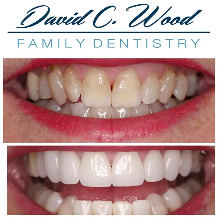 David C. Wood Family & Cosmetic Dentistry