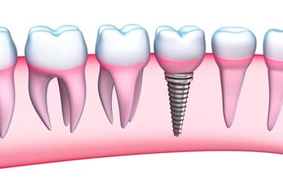 Dental Associates of New England