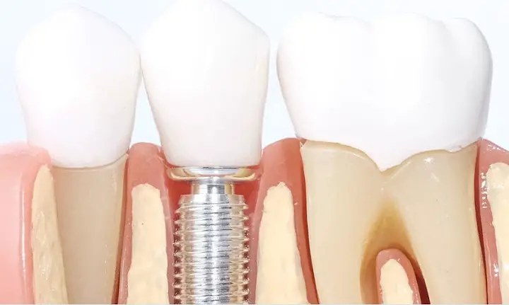 Echo Family Dental | Dentist Hutchinson MN