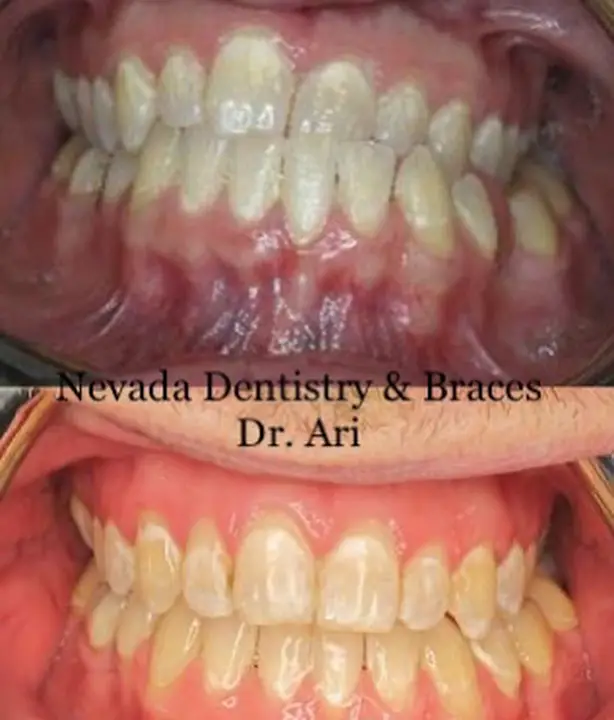 Nevada Dentistry & Braces