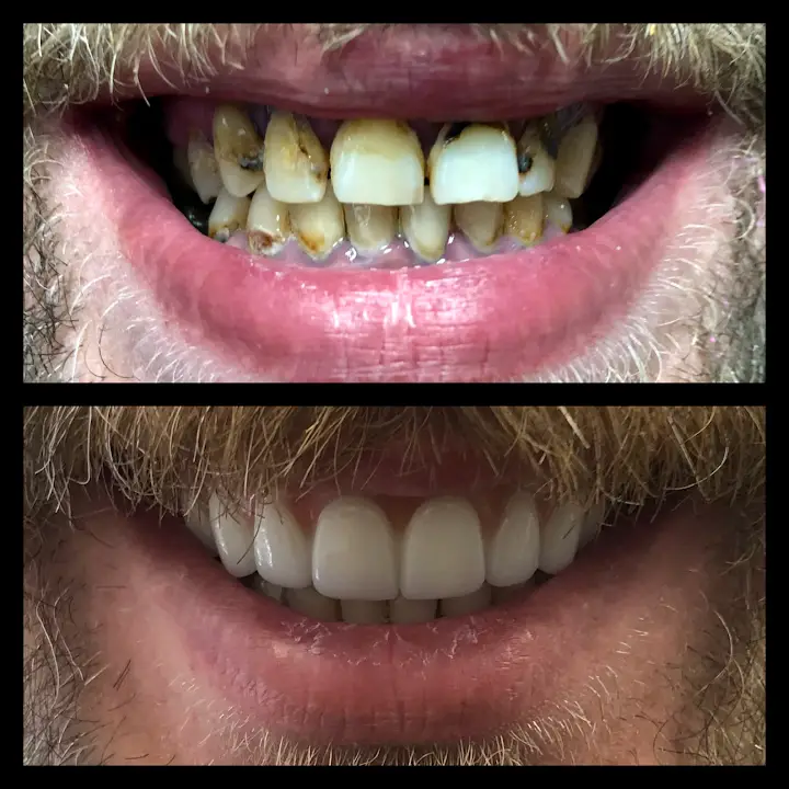 Joshua M. Ignatowicz, DMD - Dental Implants Henderson NV