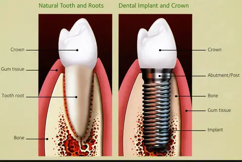 Universal Dental Implant Center