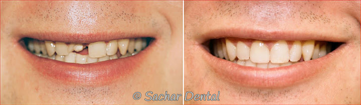 Sachar Dental NYC