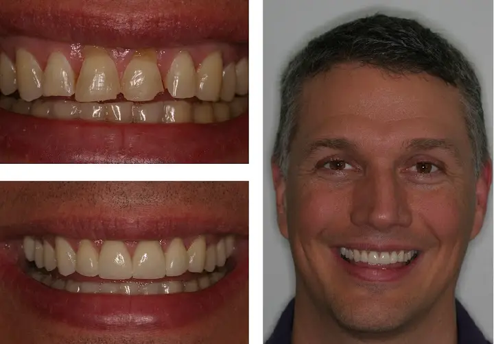 Triangle Restoration Dentistry