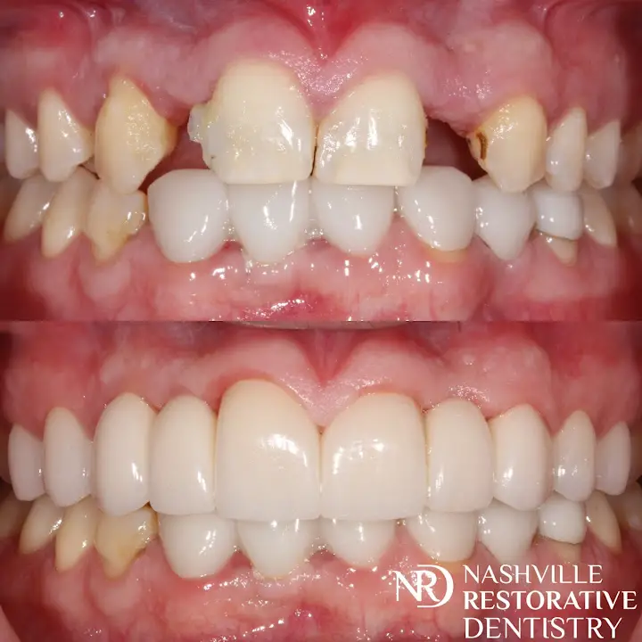 Nashville Restorative Dentistry