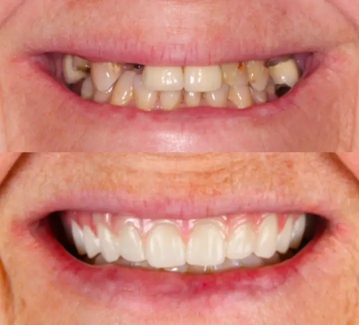 Texas Dental Clinic - implant & cosmetic dentistry