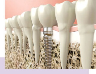 Longbranch Dental
