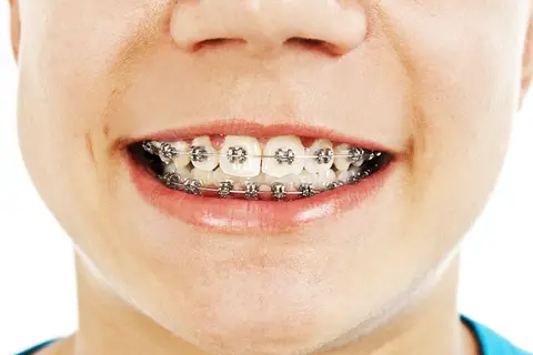 Element Dental & Orthodontics Bryan