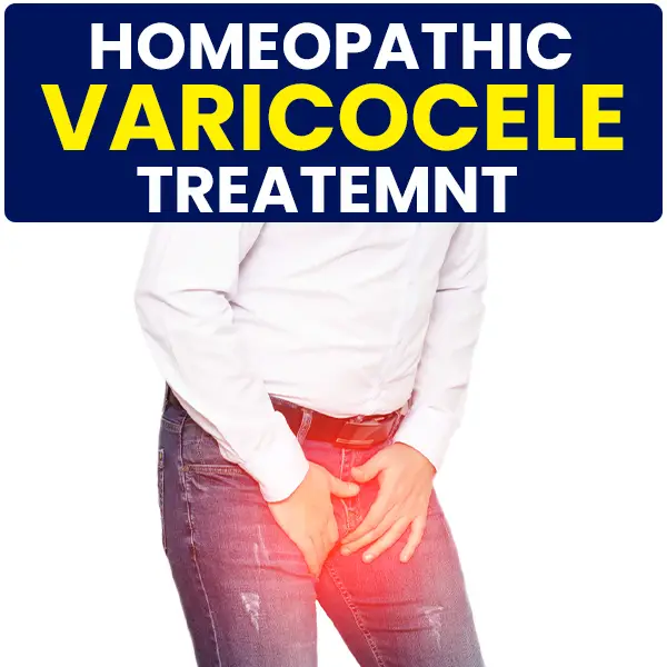 varicocele homeopathic treatment